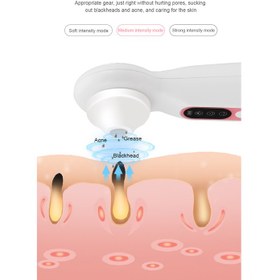 تصویر میکرودرم ذره بینی wg microderm wg