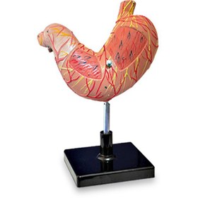 تصویر مولاژ معده 