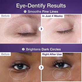 تصویر دورچشم ضدچروک و تیرگی نامبوزین شماره 9 Volumetoxکد100185 