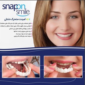 تصویر لمینت متحرک دندان Snap On Smile ا Snap On Smile Snap On Smile