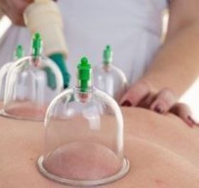 تصویر بادکش 6 سر 