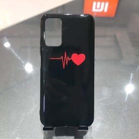 تصویر گارد ژله ایی طرح ضربان قلب برای گوشی شیائومی پوکو ام ۳/ Xiaomi poco m3 