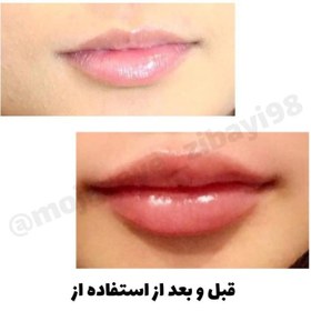 تصویر تونیک حجم دهنده لب دکس لاند lip plumper وزن ۲۰ میل 