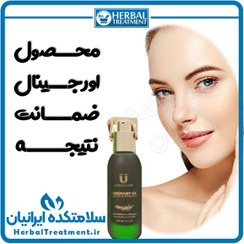 تصویر روغن رزماری اصل Rosemary Oil – رفع سفیدی مو (ضمانت اصالت کالا) 