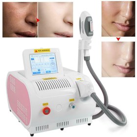 تصویر دستگاه لیزر ریمور موهای زائد اس اچ ار ایلایت ا Super Hair Removal SHR Super Hair Removal SHR