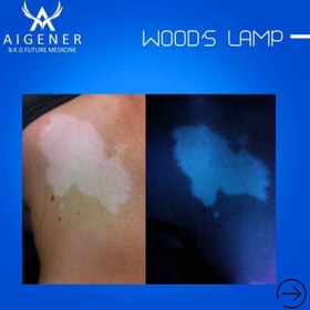 تصویر وود لامپ wood lamp شارژی 