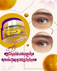 تصویر کرم تخصصی رفع گودی و تیرگی و میلیای چشم 