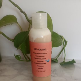 تصویر تونر ضد جوش 