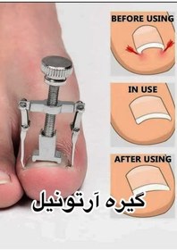 تصویر آرتونیل 