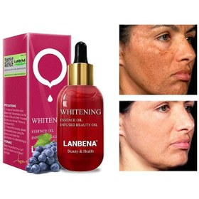 تصویر سرم سفید کننده و روشن کننده صورت برند لانبنا Lanbena ا Lanbena Whitening Essential Oil Lanbena Whitening Essential Oil