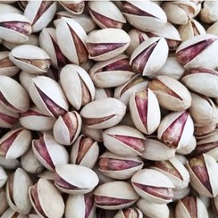 تصویر پسته احمد آقایی 