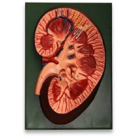 تصویر مدل کلیه دیواری 