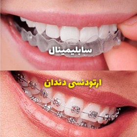 تصویر سابلیمینال ارتودنسی دندان 