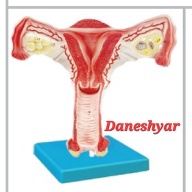 تصویر مولاژ رحم سالم Model of a healthy uterus