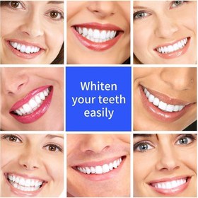 تصویر قلم سفید کننده دندان وایت دیزلینگ Dasling White Dental Pen