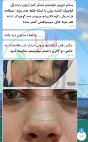 تصویر ژل کوچک کننده بینی ژل بینی