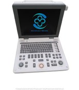 تصویر دستگاه سونوگرافی پرتابل مدیسون R3 