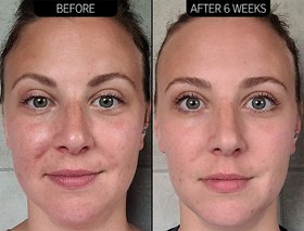 تصویر سرم ضد لک ویتامین C اینکی لیست The Inkey List Vitamin C 30% Cream