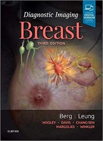 تصویر Diagnostic Imaging: Breast2020, 