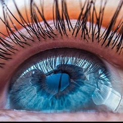 تصویر لنز رنگی یک ساله پک کامل 