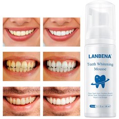 تصویر موس سفید کننده دندان لانبنا 60 میل TEETH WHITENING MOUSSE LANBENA