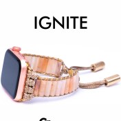 تصویر بند اپل واچ مدل ایگنایت 