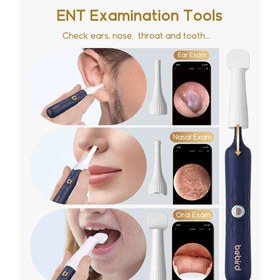 تصویر گوش پاک کن هوشمند شیائومی مدل Bebird D39R 