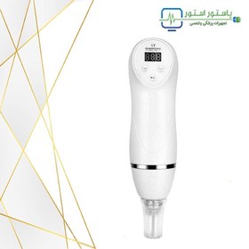 تصویر میکرودرم دیاموند diamond 