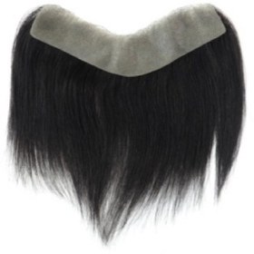 تصویر پروتز مو شقیقه 