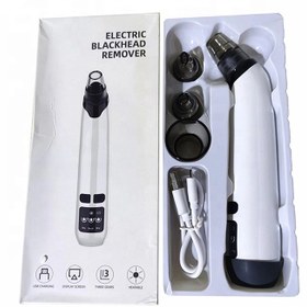 تصویر میکرودرم مدل 02 