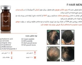 تصویر مزو مو فیوژن Hair Men Fusion F_ Hair Men