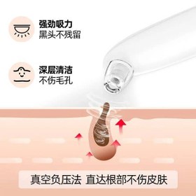 تصویر میکرودرم خانگی مدل BLACK HEAD22 